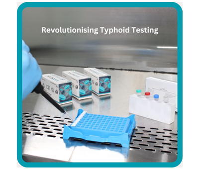 Typhoid RT PCR Test